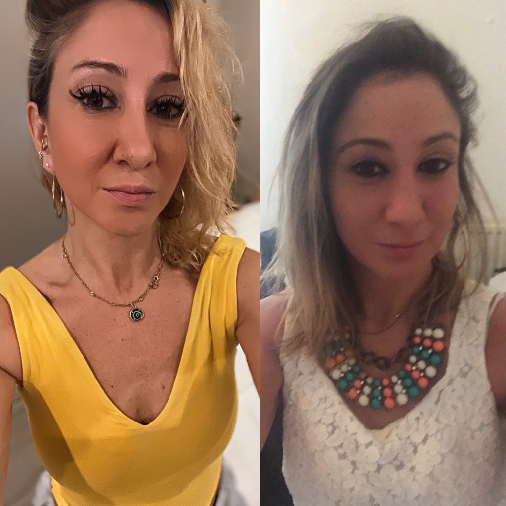 Feeling Everything at Once: The Reality of Sobriety 